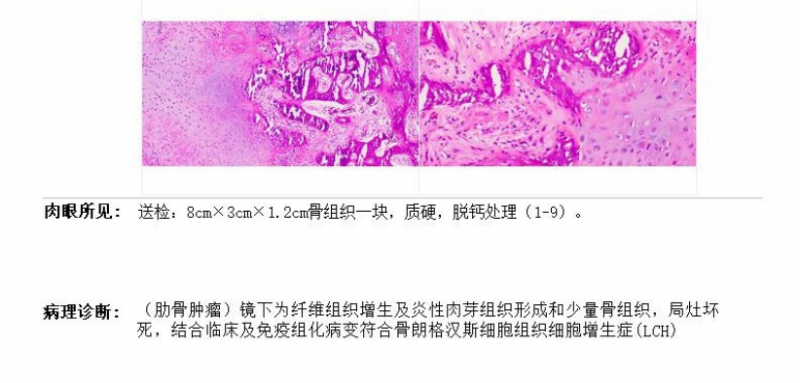 肋骨罕见病例622